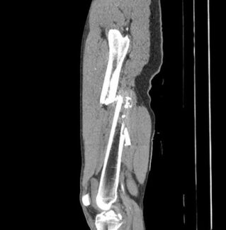 Vorbild Emergency Radiology in Amerika / Jede Sekunde zählt: Notfallradiologen retten Leben