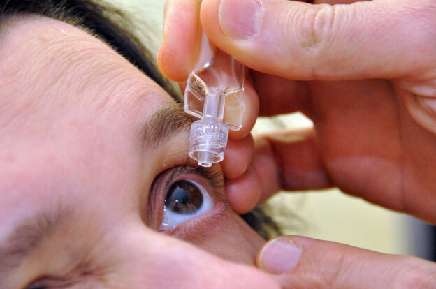 Wundermittel Serum-AT gegen schweres “Trockenes Auge”/ Diskussion um die Kostenübernahme für neue Behandlungsmethode