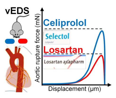 Wenn die Hauptschlagader plötzlich reisst: Ein kostengünstiges Medikament stärkt die Aorta