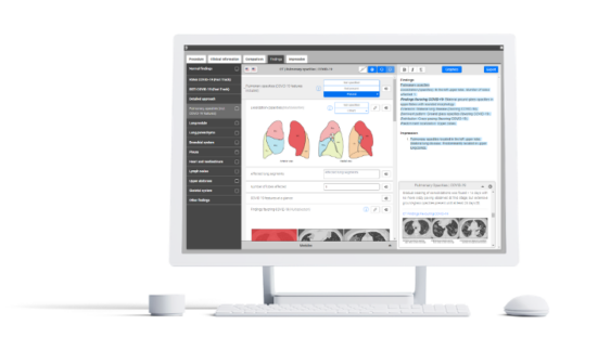 Smart Reporting stellt Radiologen eine COVID-19 Befundvorlage kostenfrei zur Verfügung