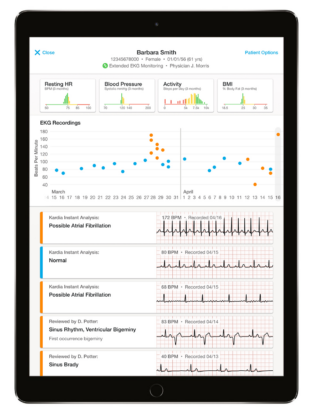 AliveCor sucht mit Kardia Mobile Testpartner für die ambulante EKG-Messung in Arztpraxen und Kliniken.