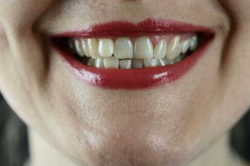 Zähneputzen hält Bakterien fern und vermeidet Plaque