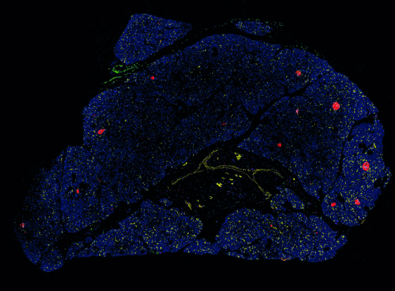 Ein Atlas der menschlichen Bauchspeicheldrüse