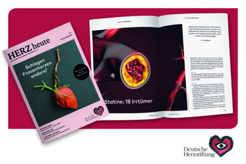 Statine: Warum sind die Cholesterinsenker bei Patienten so unbeliebt?