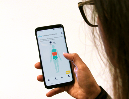 Neurodermitis-App Nia: BKK Pfalz übernimmt Kosten für die Premiumversion