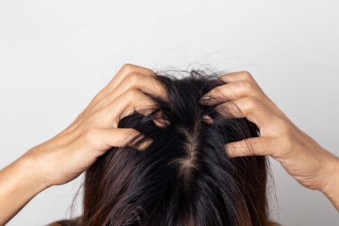 Alles Kopfsache: Haar- und Kopfhautprobleme richtig behandeln