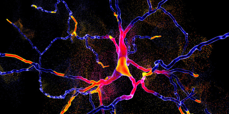 Parkinson-Therapie: Intensive Forschung