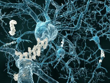 Alzheimer: Unvergessene Forschung gegen das Vergessen