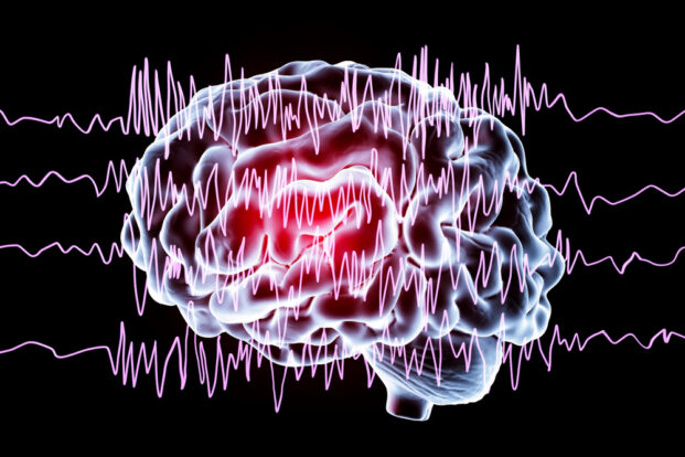 Epilepsie-Therapie im Wandel