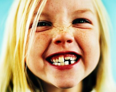 Finanztest untersucht Zahnversicherungen für Kinder / Maximale Leistungen bietet die CSS Versicherung