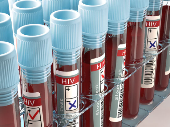 Mit HIV alt werden – Fortschritte in der AIDS-Therapie