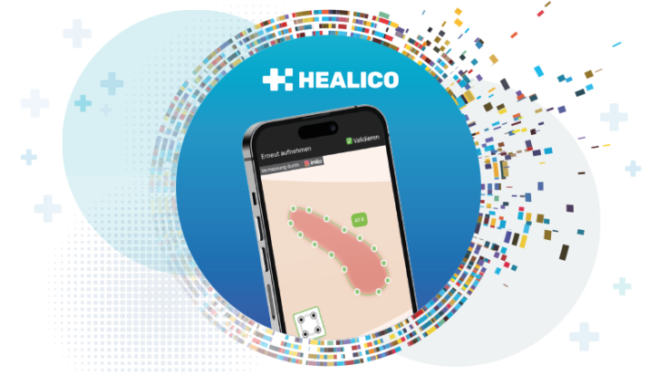 Healico-App zur digitalen Wunddokumentation punktet mit automatischer Wundvermessung