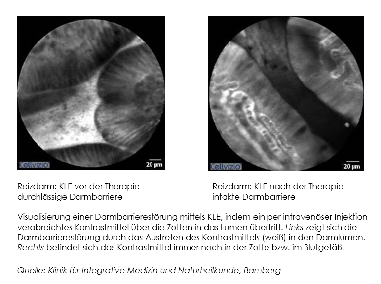 DGIM 2024: Neue Beobachtungsstudien zu RDS und CED zeigen:Myrrhe ...