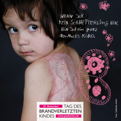 „Unfallfrei statt Böllerei“: Paulinchen e.V. ruft zum Tag des brandverletzten Kindes am 7. Dezember